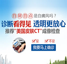 廣州308準(zhǔn)分子激光